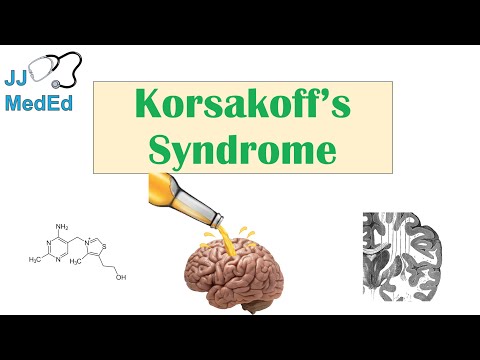 Wernicke s Encephalopathy Causes Symptom Triad Treatment