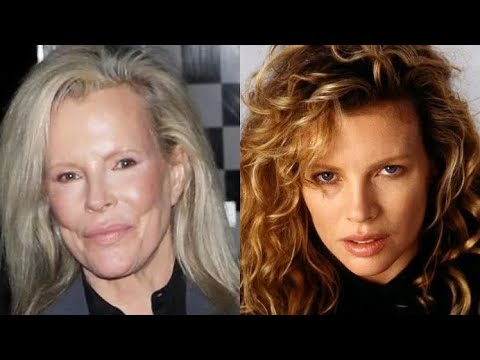 Reputedly "natural", Kim Basinger, 69, appears in public with a smooth and swollen face