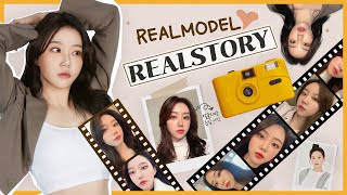 성형후기!! ◆얼굴지방흡입(이중턱제거, 볼살제거), 지방이식(이마, 앞광대)◆제 2탄◆