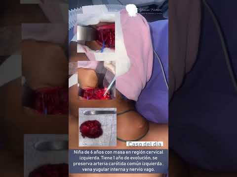 video AtSsaj23-CI