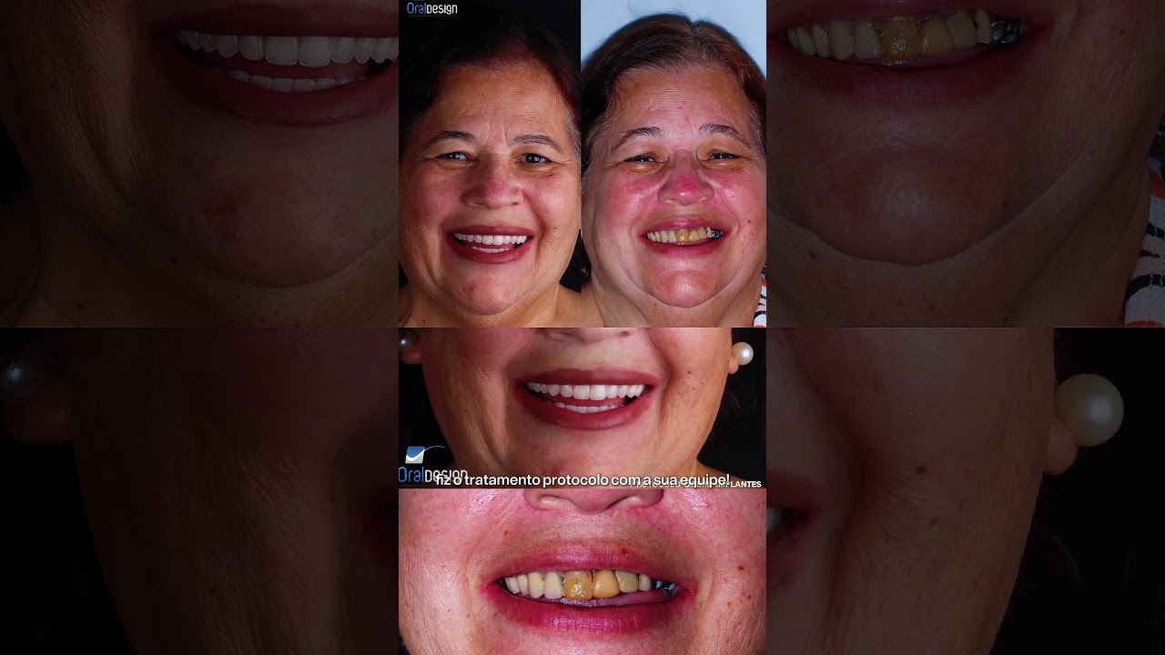 Danilo Monteiro Rezende Pereira-45