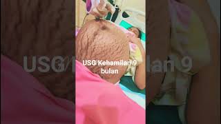 Download lagu USG Kehamilan 9 bulan #pregnant #bumil mp3 Download lagu USG Kehamilan 9 bulan #pregnant #bumil mp3