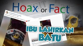 Hoax or Fact: Telanjur Viral Perempuan Melahirkan Batu di Luwu Timur, Polisi Beberkan Hasil Medis