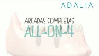 All on 4 Clínica Dental Adalia