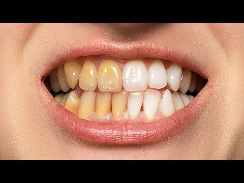 The BEST Way to Whiten Teeth in Photoshop Video