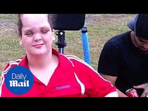 Teenager has 'baby lungs' due to rare condition - Daily Mail