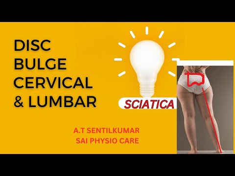 DISC BULGE LUMBAR VS CERVICAL ONLINE CHAT