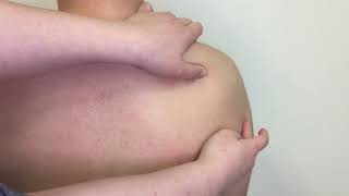 Palpation of Bony Landmarks on Scapula