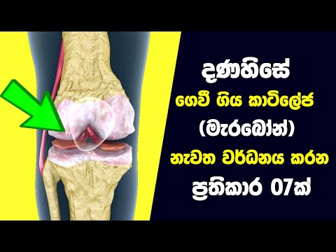 දණහිසේ ගෙවී ගිය කාටිලේජ නැවත වර්ධනය කරන ප්‍රතිකාර 7 | Knee Cartilage Regeneration Home Remedies