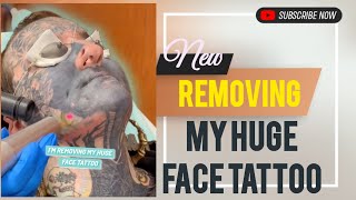 Removing My Huge Face Tattoo