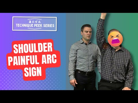 The Painful Arc Sign Test For Shoulder | Technique Peek Series