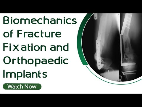 Biomechanics of Orthopaedic Implants