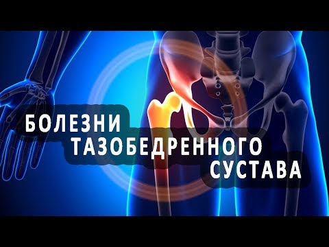 Как избавиться от шейного остеохондроза упражнения Какую мазь можно использовать при болях в спине при грудном вскармливании