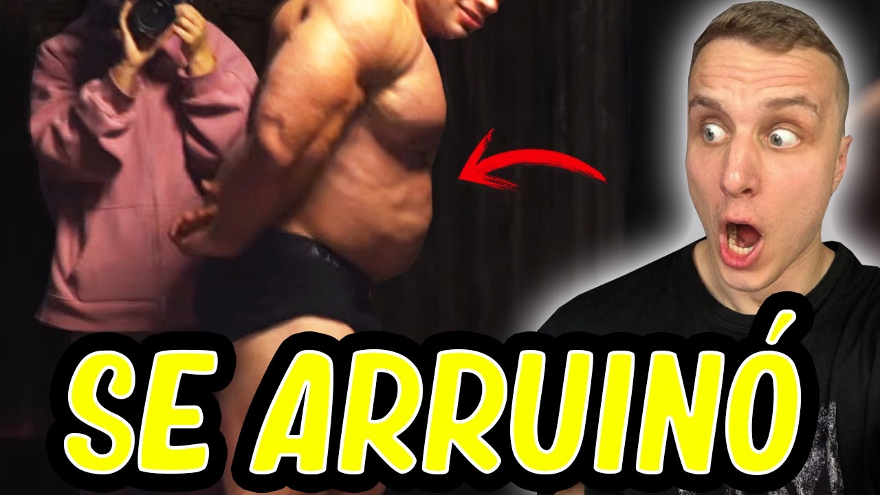 La barriga extrema de Genetic Anomaly *se acabó su carrera antes de empezar*