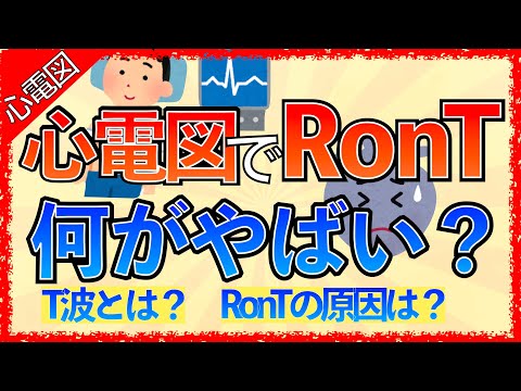 トルサード ド ポアントについて詳しく解説