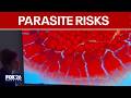What to know about parasites: Risks, symptoms & testing