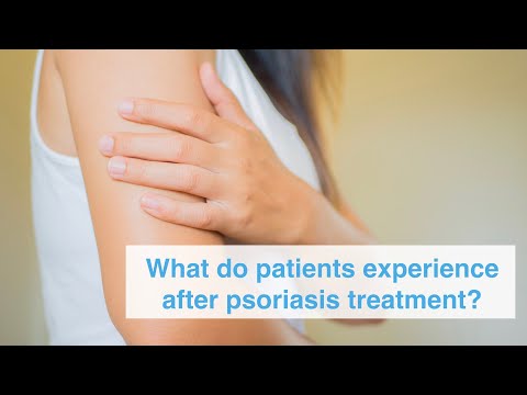 What do patients experience after psoriasis treatment?