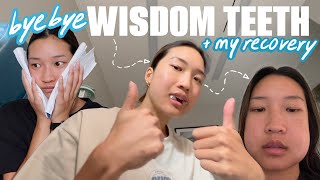 GETTING ALL MY WISDOM TEETH REMOVED *surgery recovery vlog*