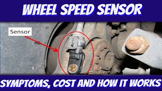Wheel Speed Sensor Replacement Cost, How it Works, Symptoms, and More Common Questions