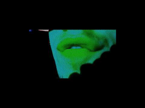 NadoAndrzejewski "Aby"