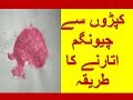 Kapron Se Chiwing Gum Utarne Ka Tarika