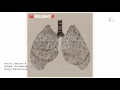 Relient K | Collapsible Lung_Boomerang.mp4