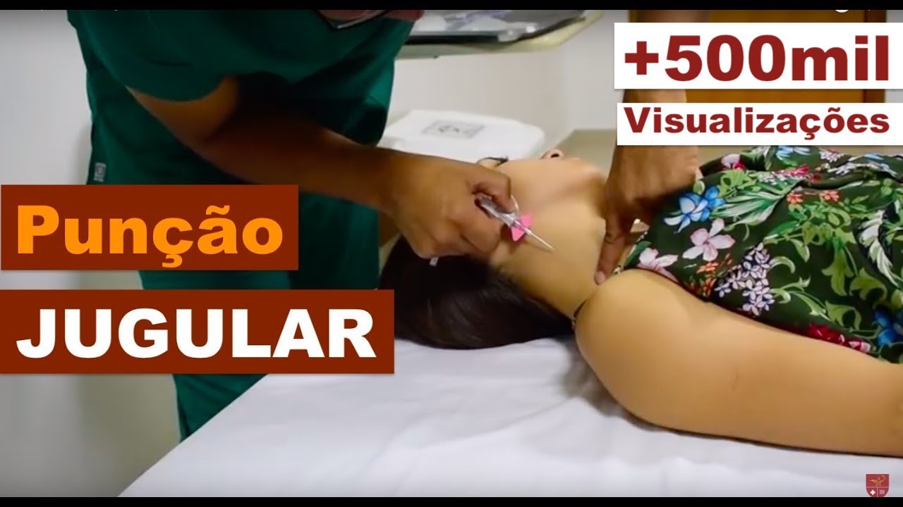Punção de Jugular
