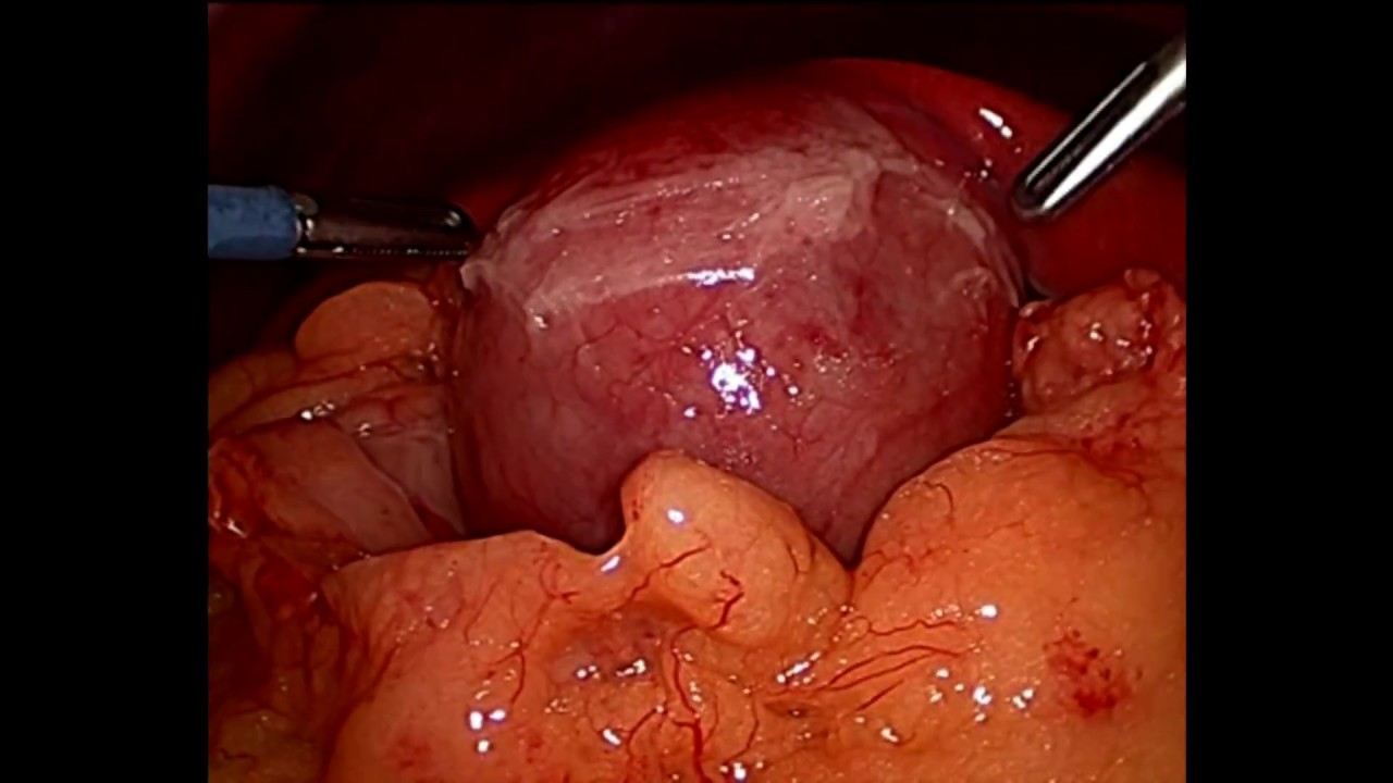 Xavier Botet Del Castillo-9