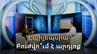 Էպիլեպսիա. Բուժվո՞ւմ է արդյոք | Առողջություն ւ գեղեցկություն | 21.03.2023