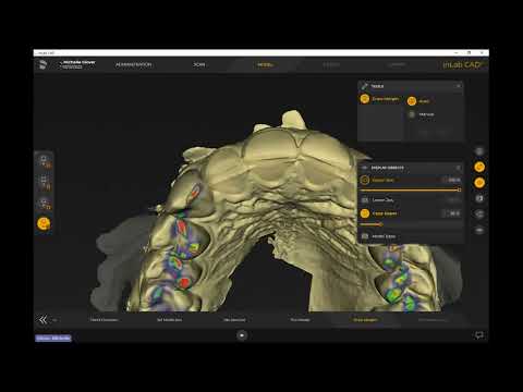 Digital Wax-Ups: InLab CAD 22