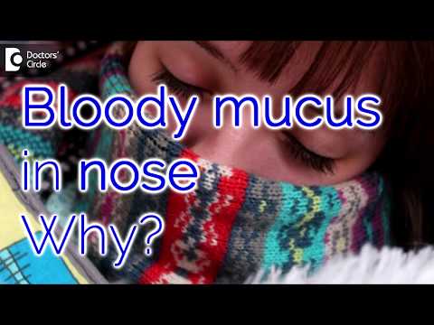 Why do I have bloody mucus in my nose? How it can be managed? - Dr. Satish Babu K