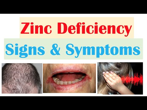 Zinc Deficiency Signs & Symptoms (ex. Hair Loss, Acne, Infections) & Why They Occur