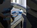 Avn Treatment With Latest Robotic Laser Avascularnecrosis Hipjointpain Osteonecrosis Causeofhip