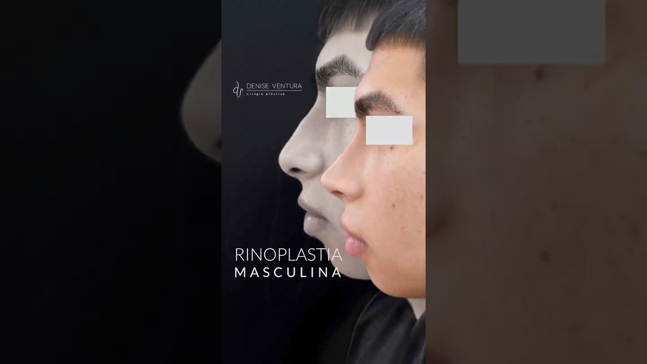 Denise Ventura Perez-24