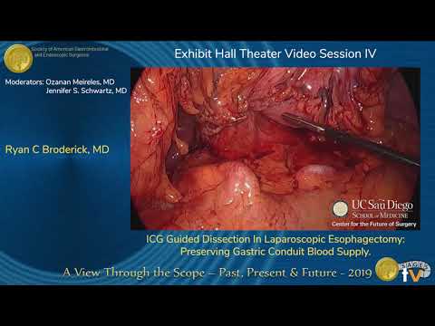 ICG Guided Dissection In Laparoscopic Esophagectomy: Preserving Gastric Conduit Blood Supply