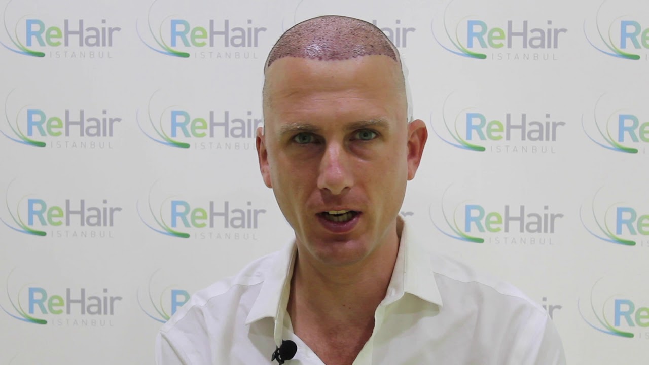 ReHair Istanbul - Review - Haartransplantatie in Istanbul, Turkije
