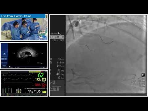 PCI Of CTO Lesion With ADR