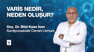 Varis Nedir, Neden Oluşur? | Türkiye Hastanesi