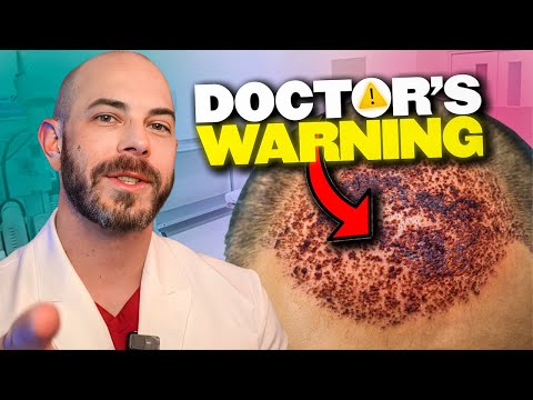 What You Should Know Before Getting a Hair Transplant - Doctor Explains