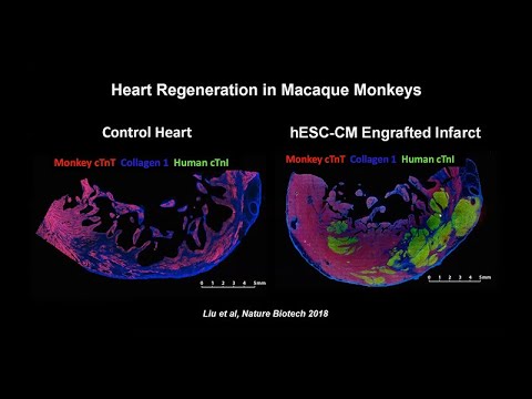 From COVID-19 to Heart Regeneration: The Pluripotent Uses ...