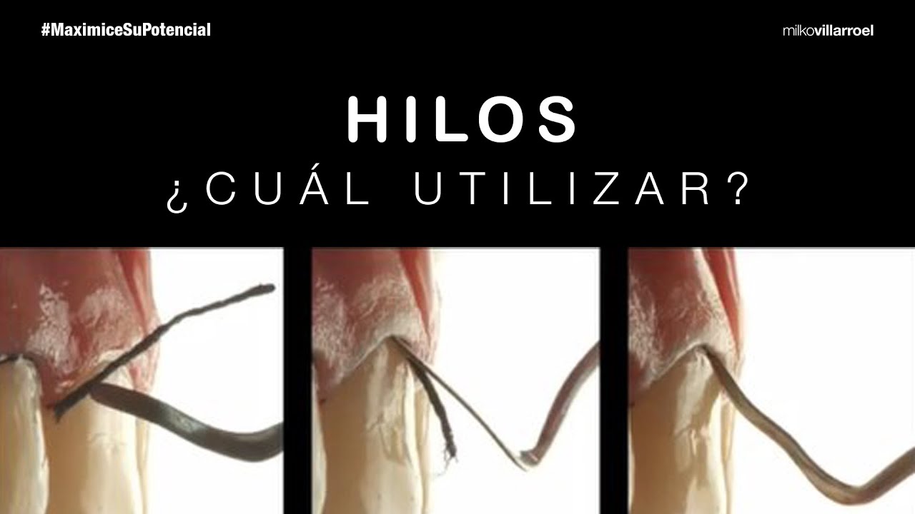 HILO RETRACTOR ¿Cuál utilizar | #MaximiceSuPotencial | Milko Villarroel