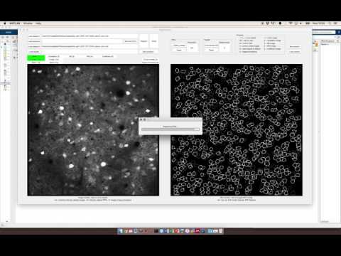 Suite2P/registers2p/Readme.md at master · cortex-lab/Suite2P · GitHub