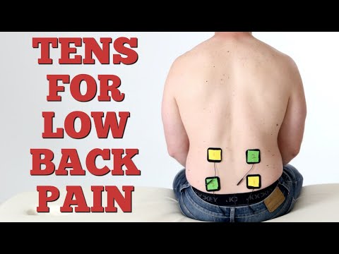 How to Use a TENS Unit With Low Back Pain. Correct Pad Placement