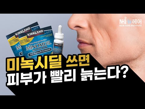 미녹시딜 쓰면 노화와요? - 뉴헤어 I 탈모치료