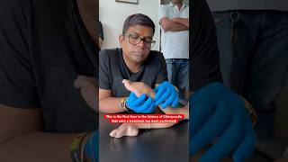 Download lagu This is the first time in the history of Chiropractic that such a treatment has been performed! mp3