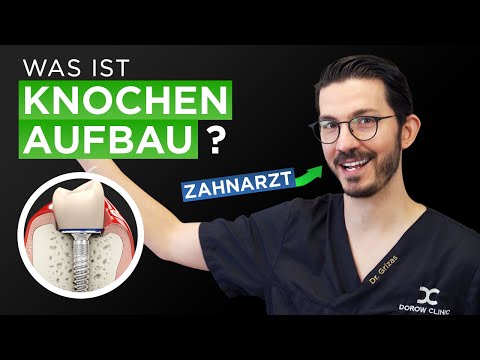 Zahnimplantate - So funktioniert der Kieferknochenaufbau