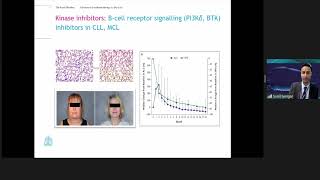 Advances in lymphoma therapy  by Dr Sunil Iyengar