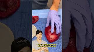 Lampert Md Plastic Surgery
