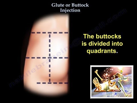 Glute injection - Everything You Need To Know - Dr. Nabil Ebraheim