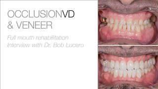 Full Mouth Rehabilitation - Interview with Dr. Bob Lucero